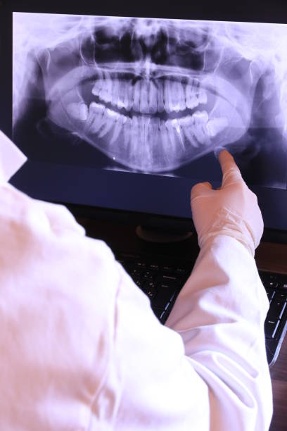 Best Emergency Dental Filling Replacement  in Chetopa, KS